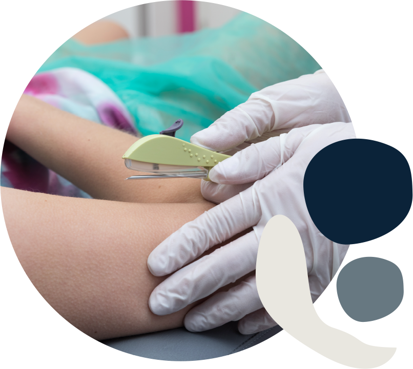 A medical professional wearing white gloves uses a light green handheld skin stapler to close a small incision on a patient's arm in a clinic.