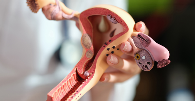 Detailed anatomical model of the uterus, highlighting various uterine conditions and structures for educational purposes.