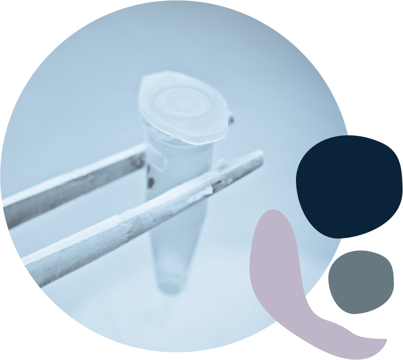 Sperm freezing (sperm cryopreservation or sperm banking), is the collecting, freezing, and storing of sperm to be used in fertility treatment at a later date.